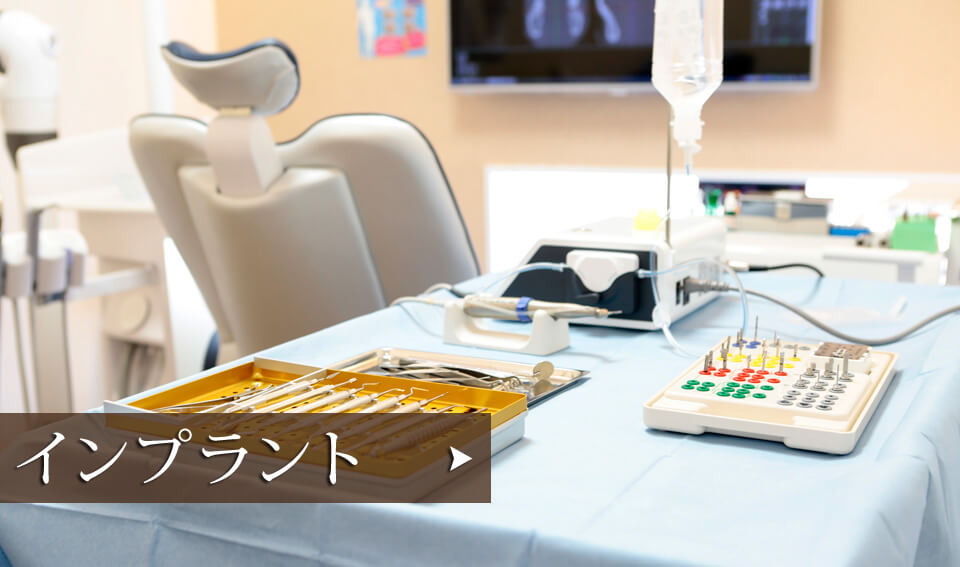 インプラント