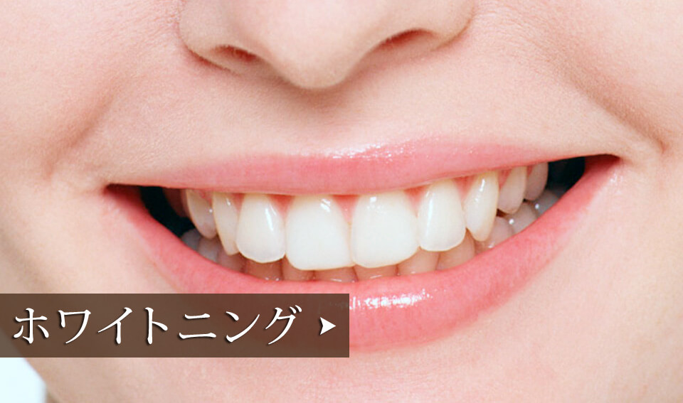 ホワイトニング